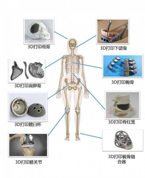 金属3D打印的后续处理工艺详解