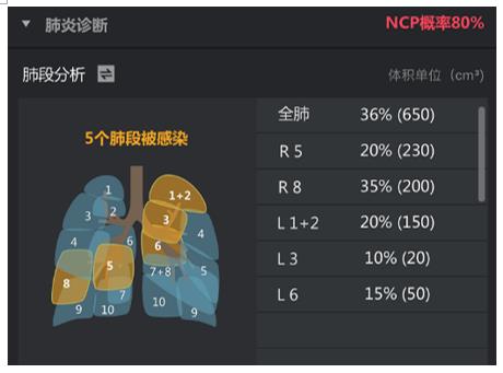 上海公卫临床中心、武汉火神山医院引入人工智能技术，直击新冠肺炎分诊难题