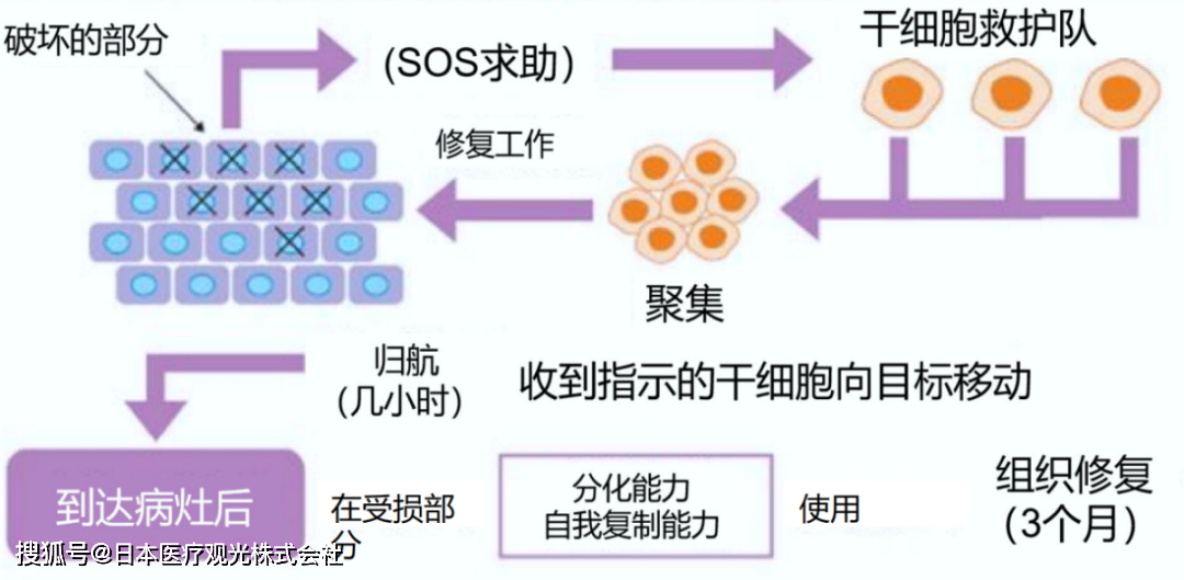 JMT-干细胞治疗糖尿病