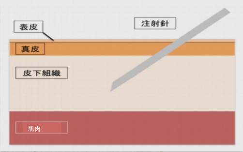 JMT-日本干细胞上清液的主要作用是什么呢？