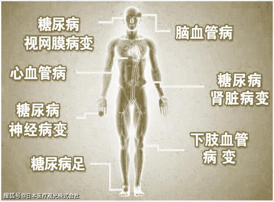 JMT-干细胞治疗糖尿病