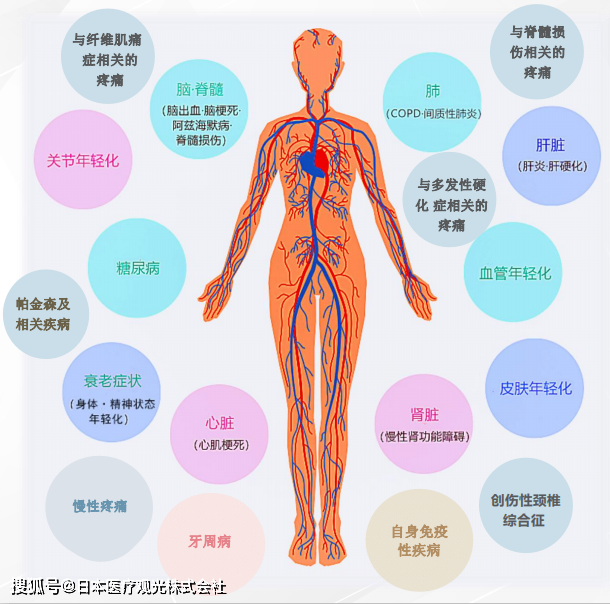 JMT-干细胞治疗糖尿病