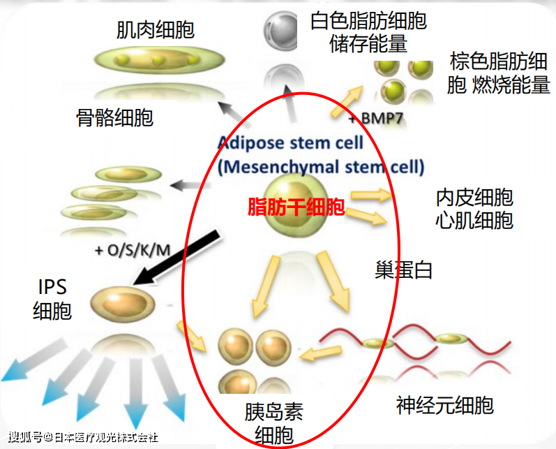 JMT-干细胞治疗糖尿病